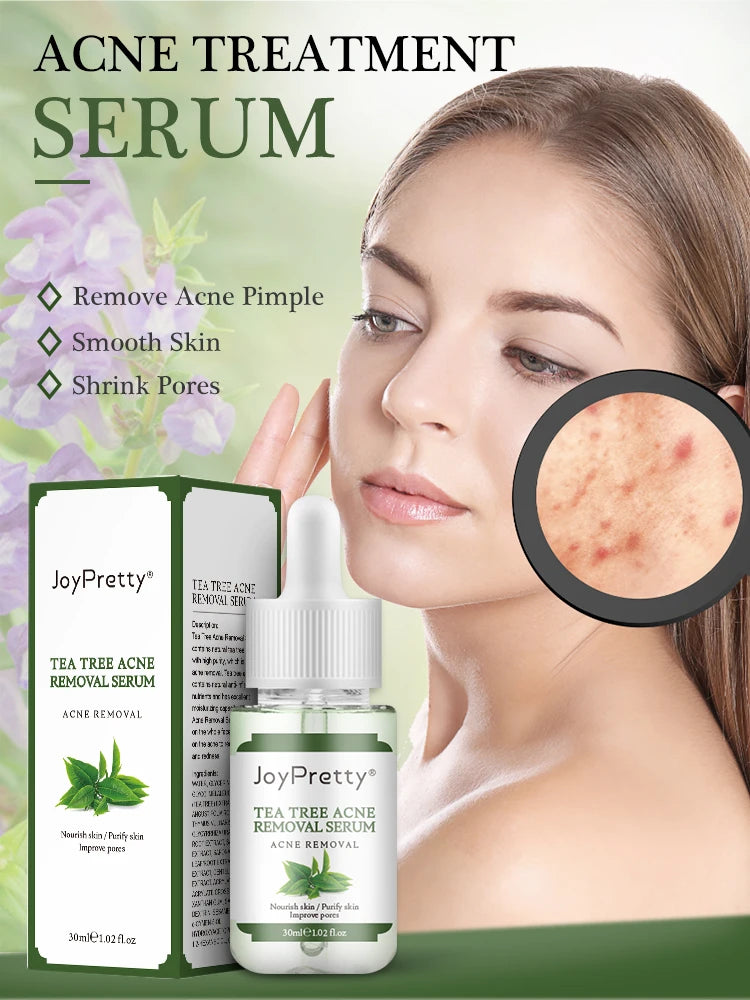 JoyPretty Acne Treatment Face Cream Tea Tree Serum Cleaning Pimple Acne Removal Repair Pores Korean Cosmetics Skin Care Kit 6pcs