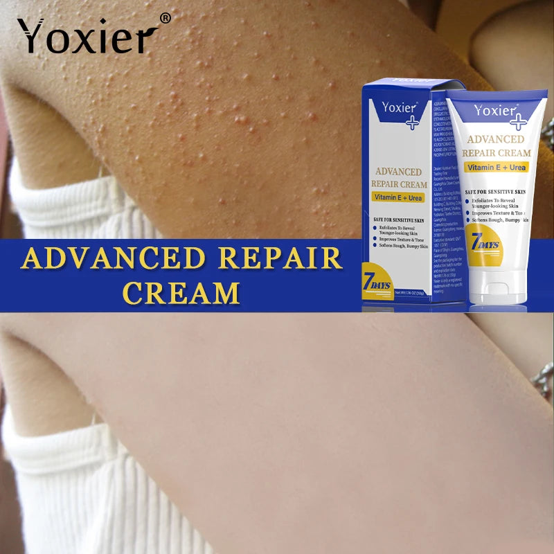 Remove Keratosis Pilaris Repair Cream Improve Skin Defects Impurities Roughness Dryness Moisturizing Body Care Vitamin E 50g