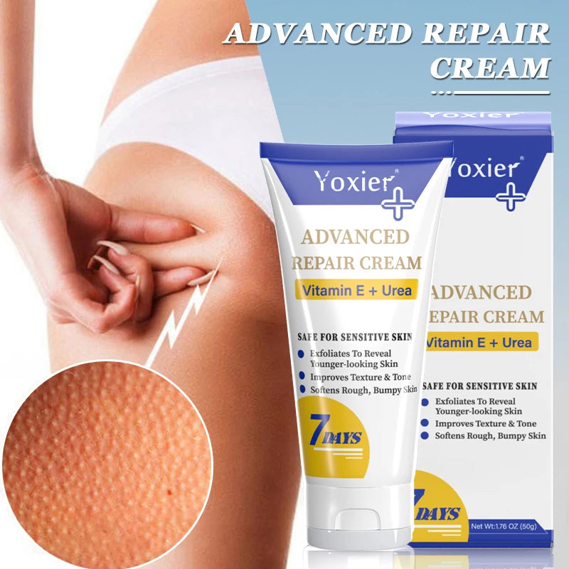 Remove Keratosis Pilaris Repair Cream Improve Skin Defects Impurities Roughness Dryness Moisturizing Body Care Vitamin E 50g